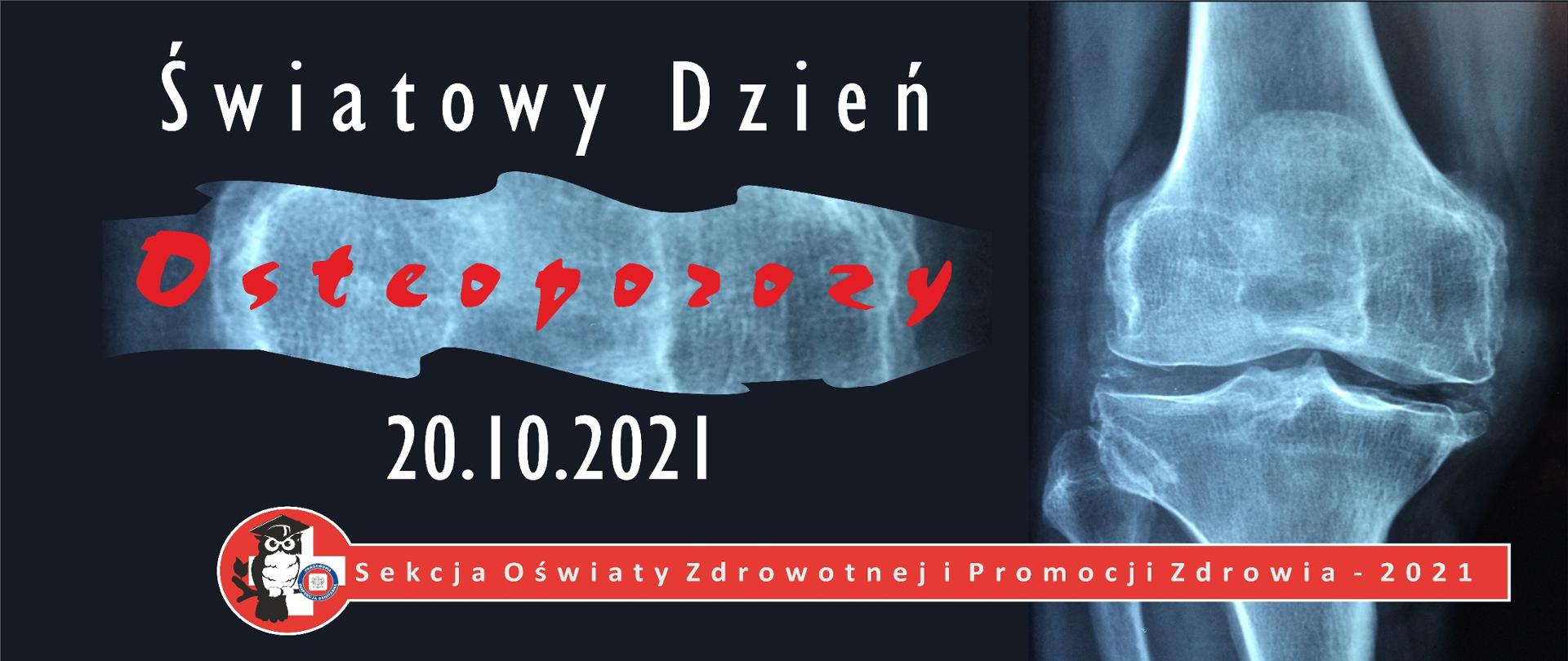 Światowy Dzień Osteoporozy 