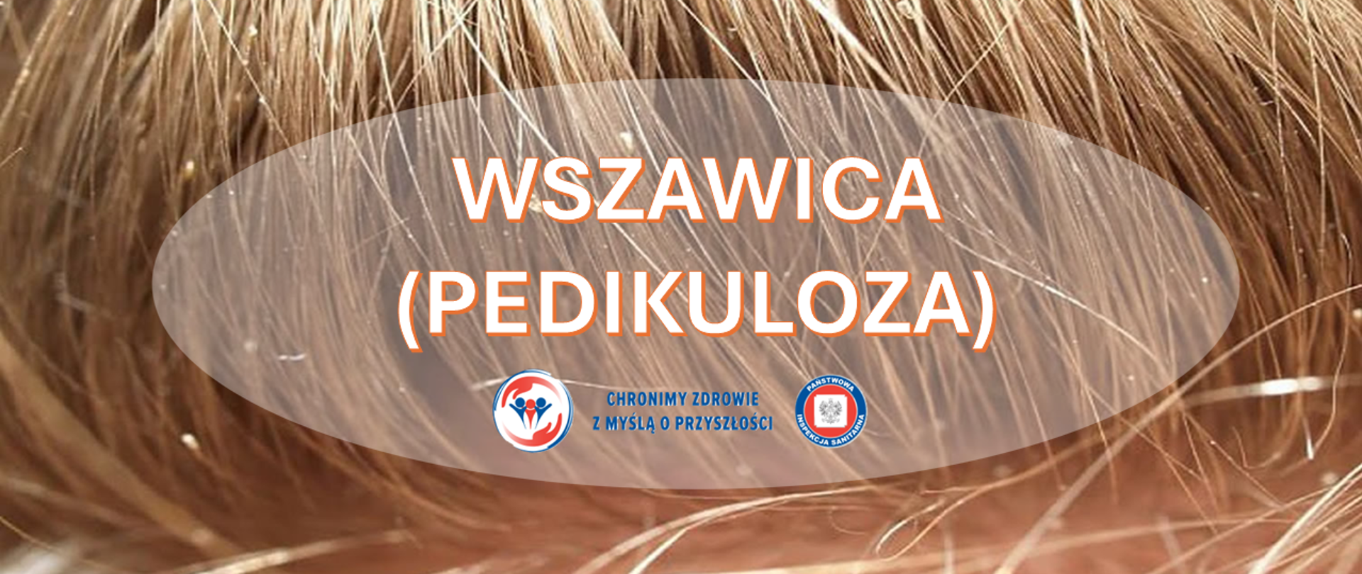 Zbliżenie na pasma blond włosów przedstawione w dużym powiększeniu. Na środku umieszczony jest napis ‘Wszywica (pedikuloza)’. Na dole widoczne są dwa logotypy Państwowej Inspekcji Sanitarnej wraz z hasłem: "Chronimy zdrowie z myślą o przyszłości"