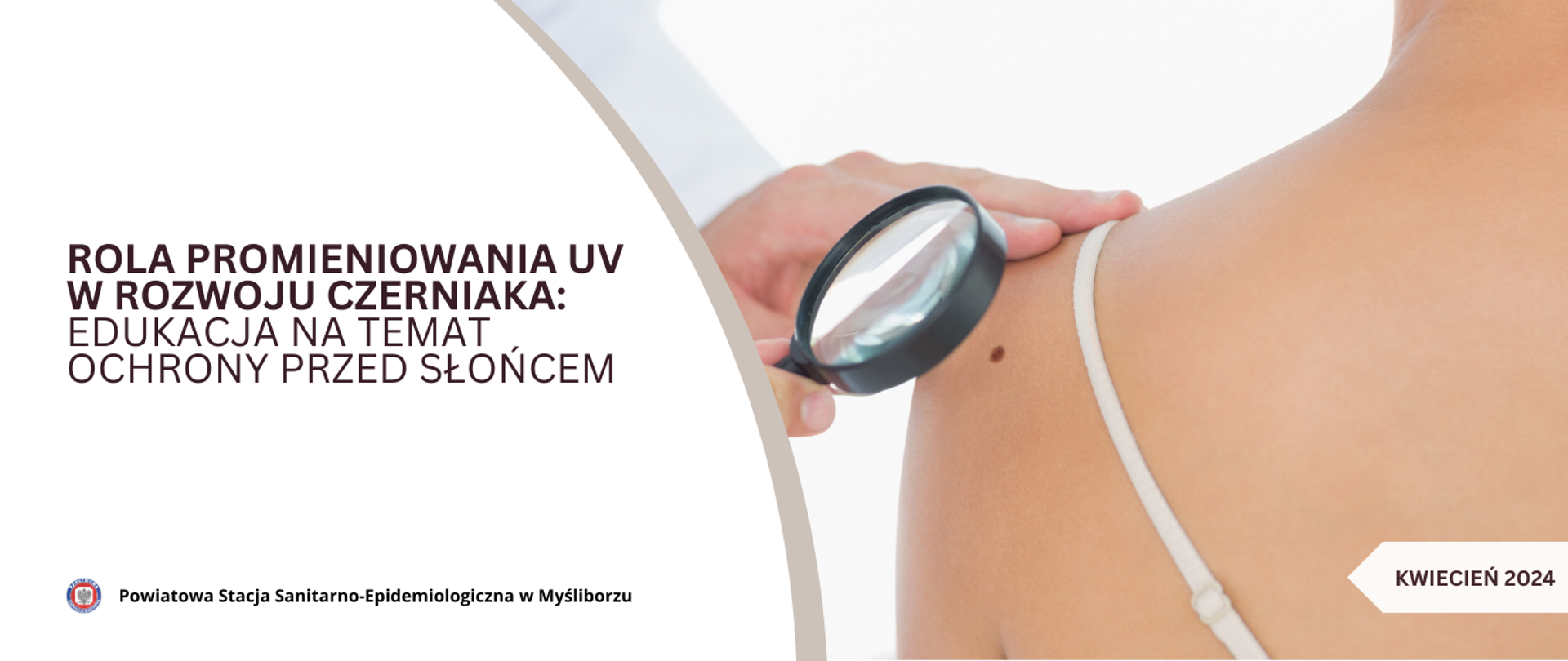 Rola promieniowania UV w rozwoju czerniaka_ Edukacja na temat ochrony przed słońcem