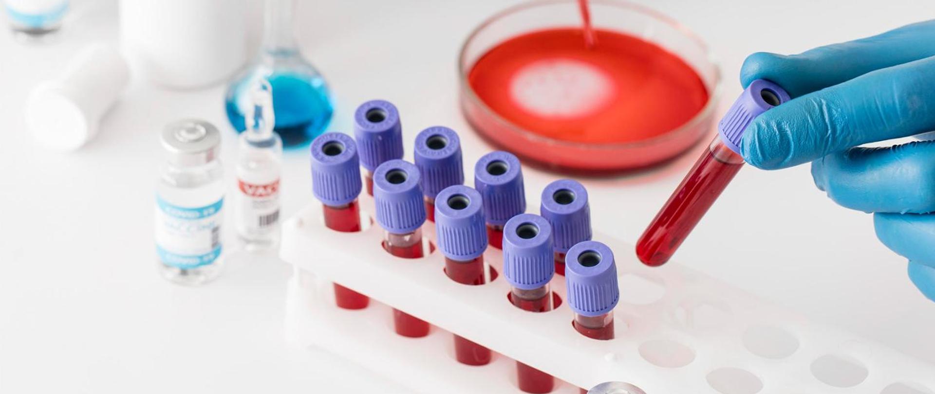 WSSE punkt pobrań krwi i wymazów 1460x616