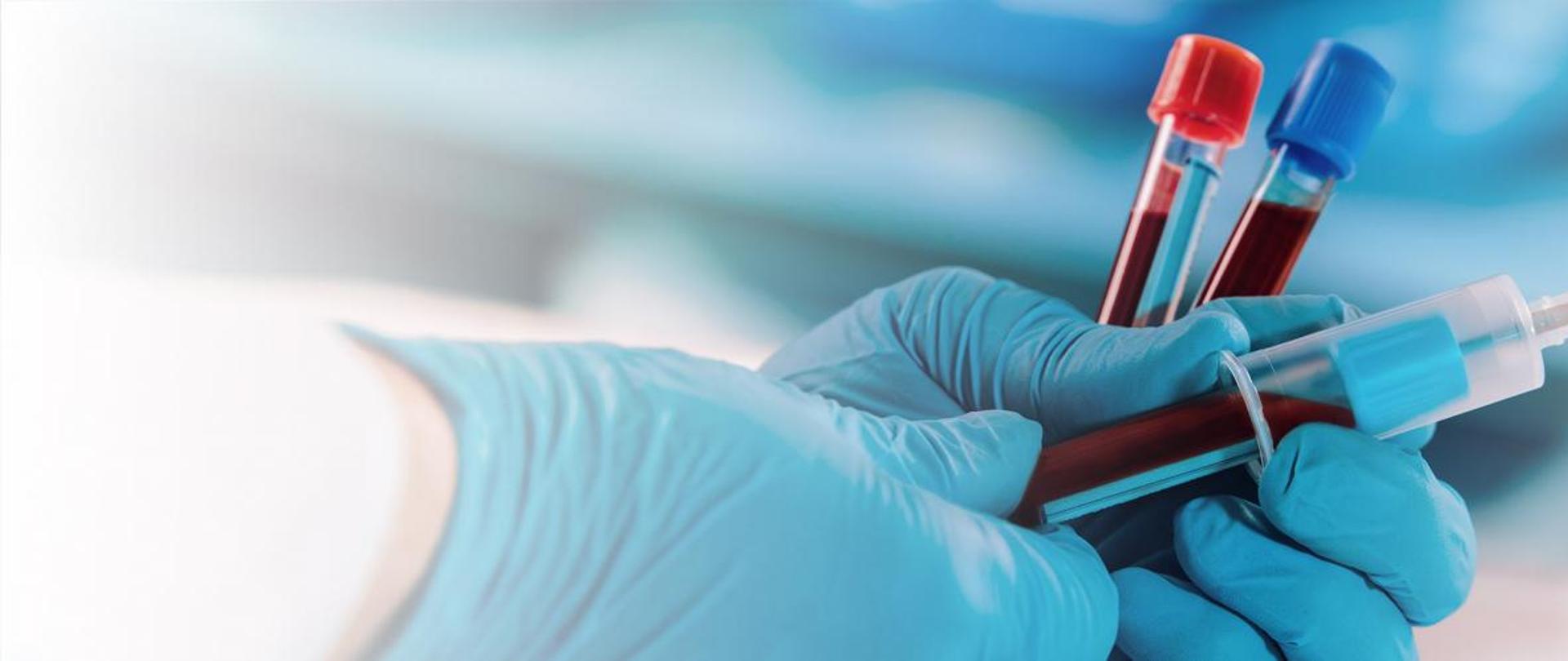 Profilaktyka chorób układu krążenia (CHUK)