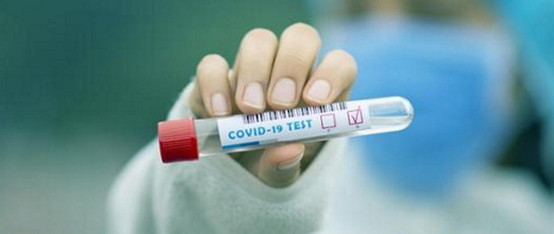 fiolka laboratoryjna w dłoni