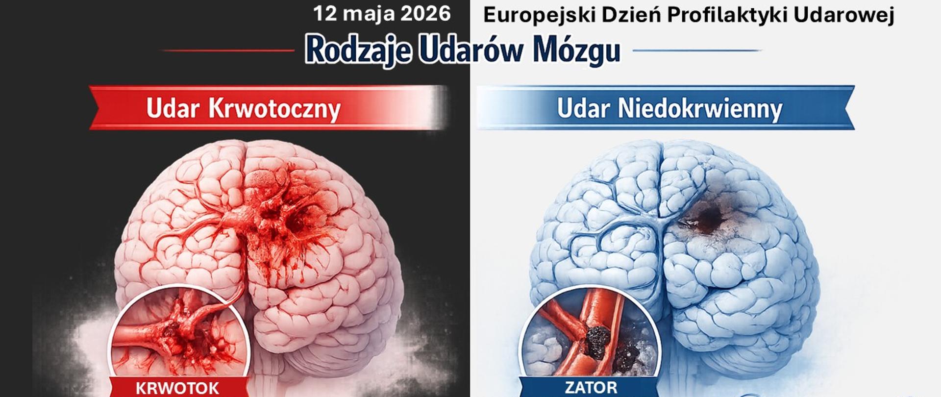 12 maja Europejski Dzień Profilaktyki Udarowej - grafika przedstawiająca obrazowo udar krwotoczny i udar niedokrwienny