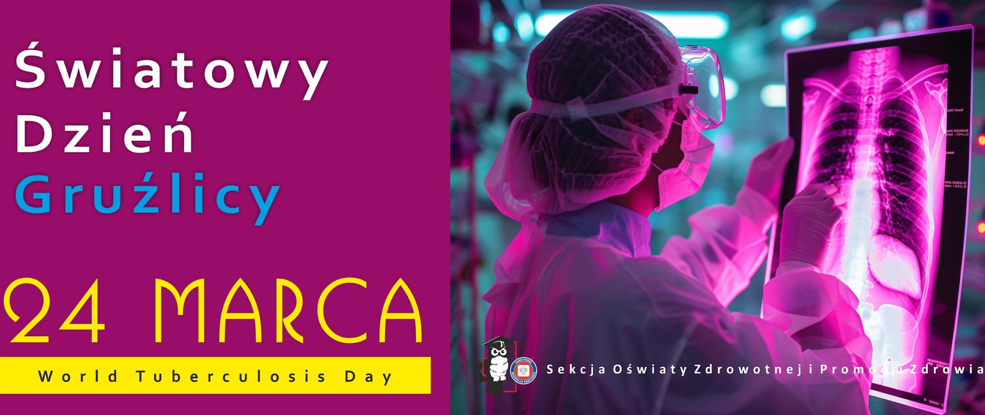 Światowy Dzień Gruźlicy 2025 24 marca, kobieta patrzy na zdjęcie rentgena płuc