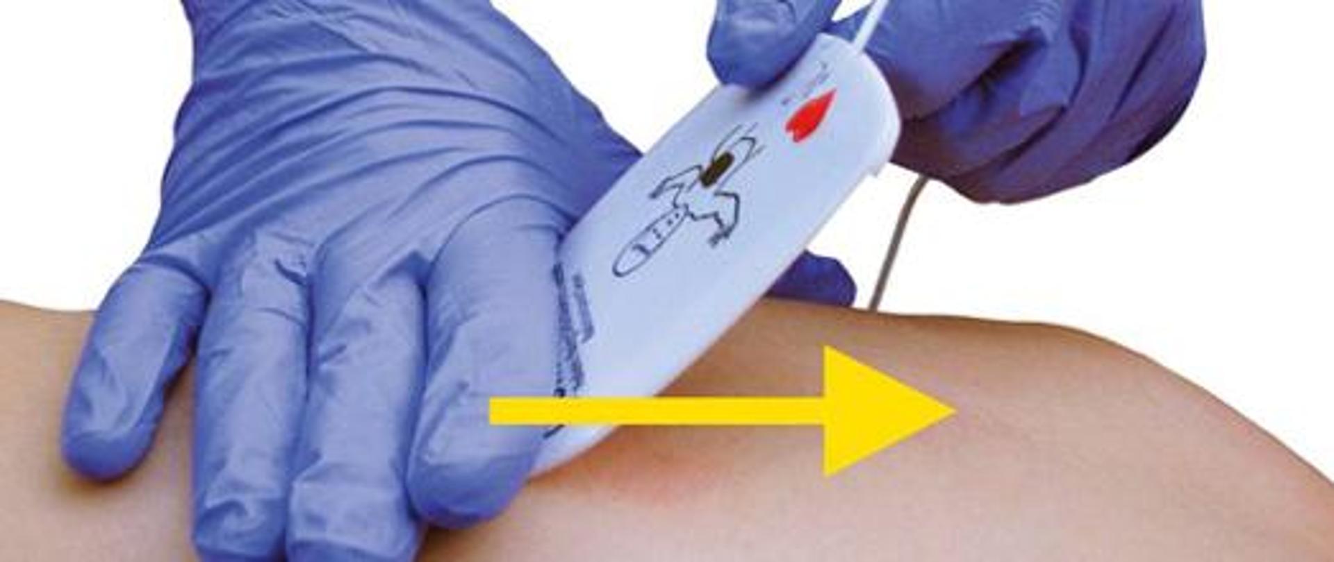Sposób prawidłowego naklejenia elektrod AED na ciało pacjenta. Na rękach instruktora rękawiczki. Elektroda naklejana z góry na dół. 