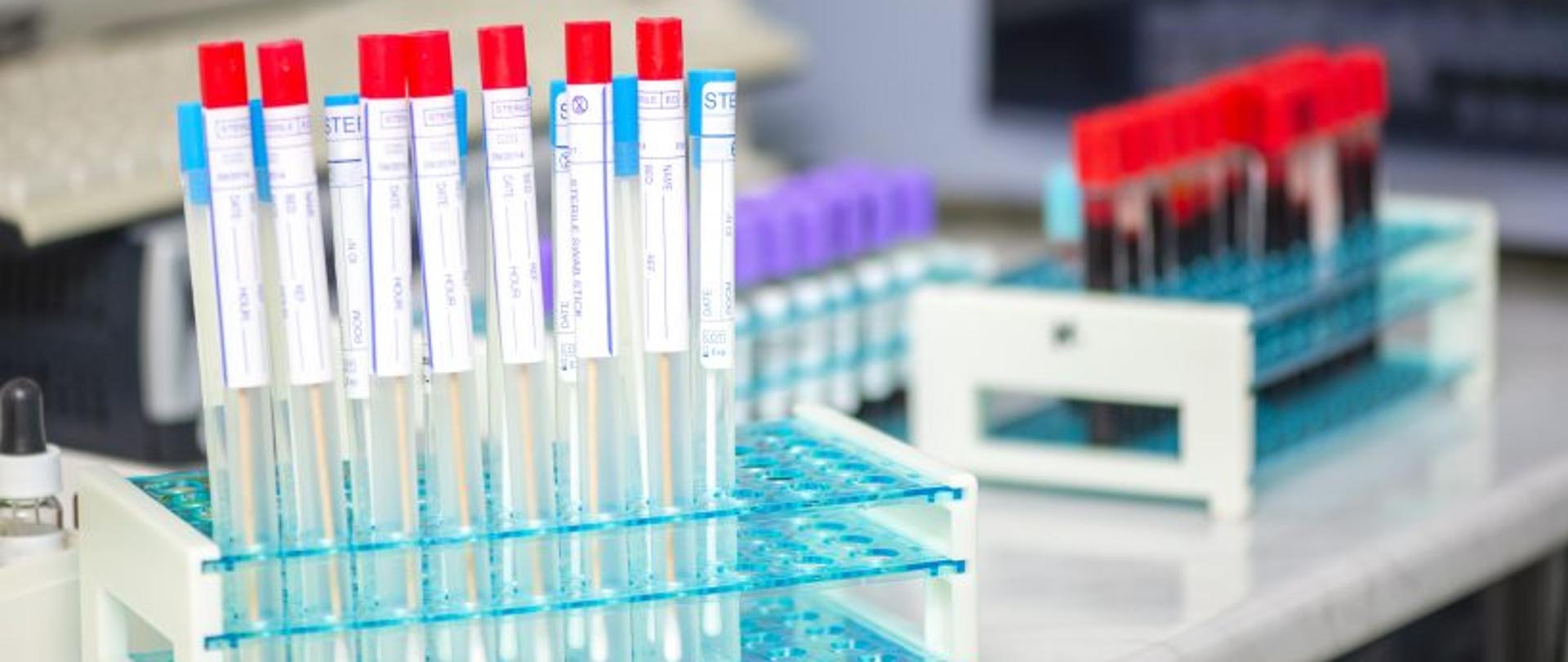 Przyjmowanie próbek kałowych i biologicznych testów kontroli skuteczności sterylizacji (sporale)