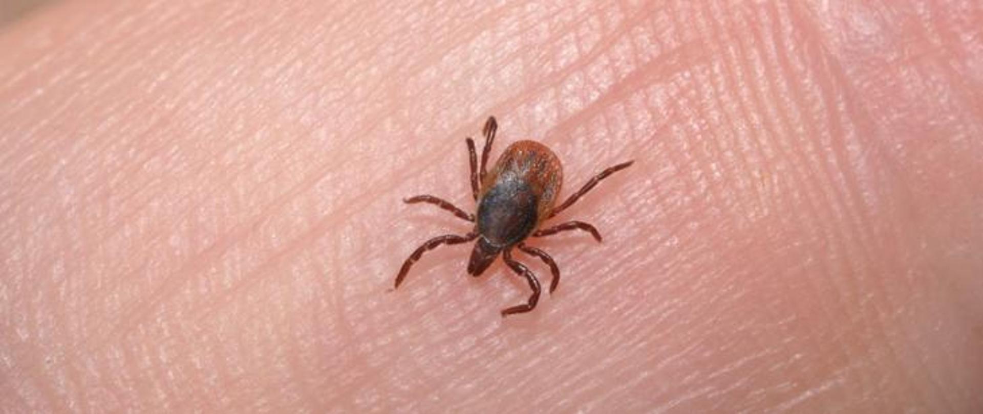 Kleszcz na skórze