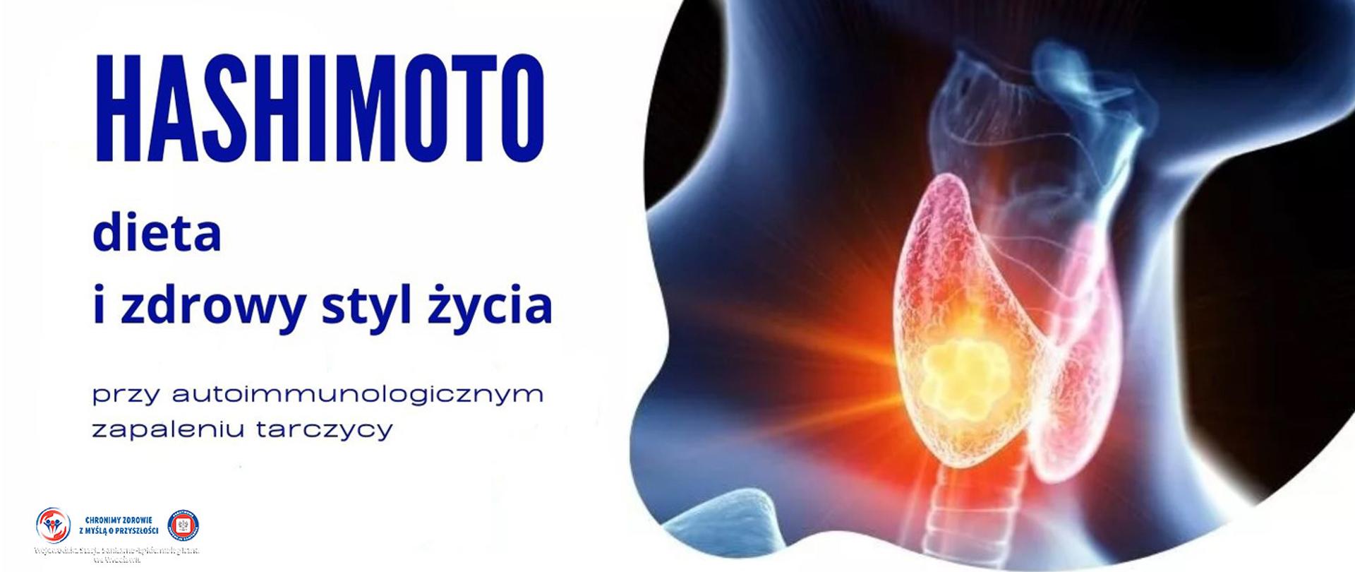 Grafika 3D przedstawiająca tarczycę 