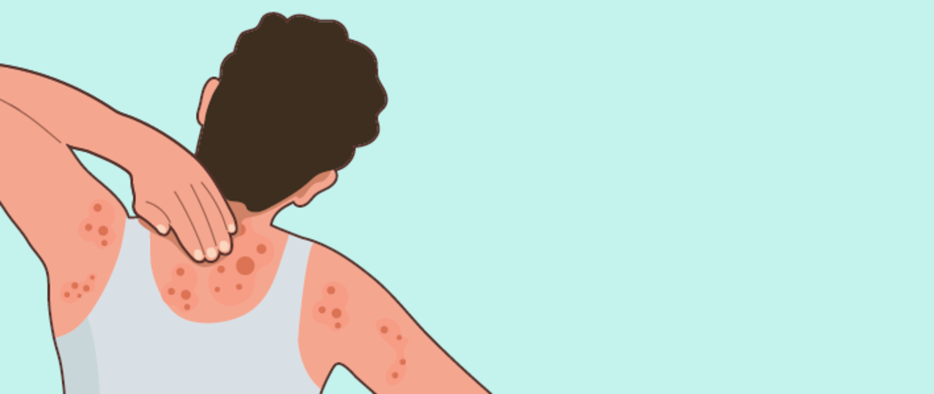 Na grafice jest osoba odwrócona tyłem, na jej ciele widać krosty. Tło jest zielone.