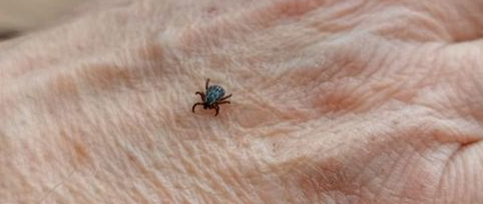 Fotografia ludzkiej dłoni, a na niej wędrujący kleszcz.