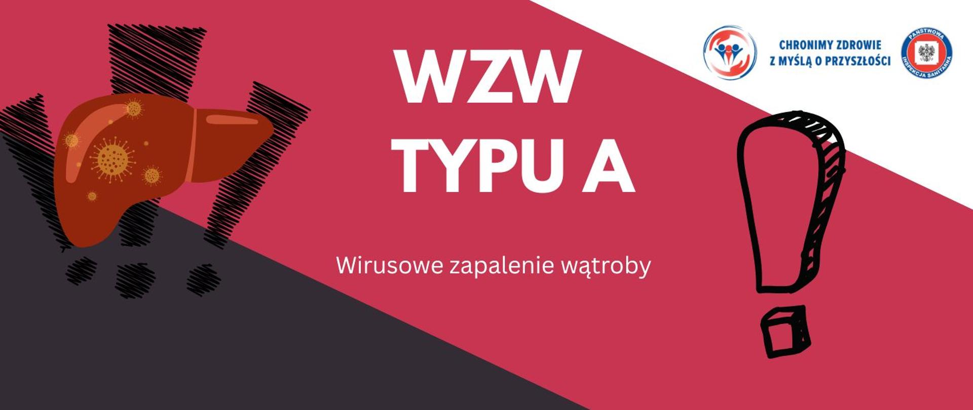 Wirusowe zapalenie wątroby typu A