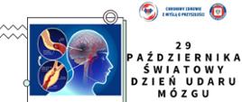 29 października Światowy Dzień Udaru Mózgu