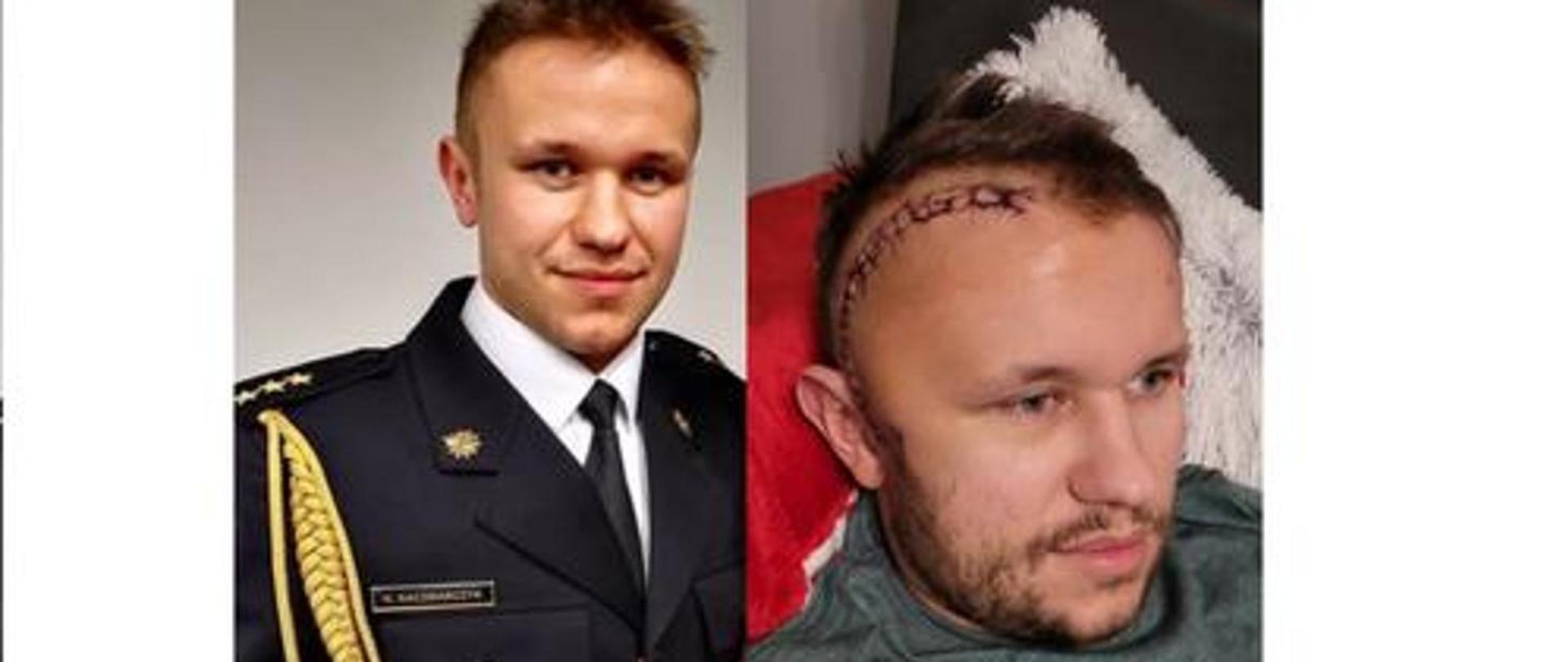 POTRZEBNA POMOC dla strażaka z Komendy Powiatowej PSP w Legionowie!