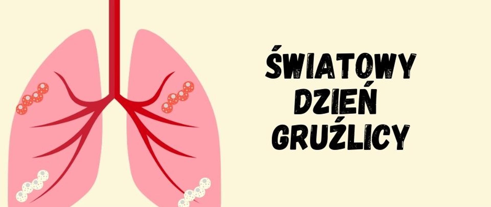 Światowy Dzień Gruźlicy