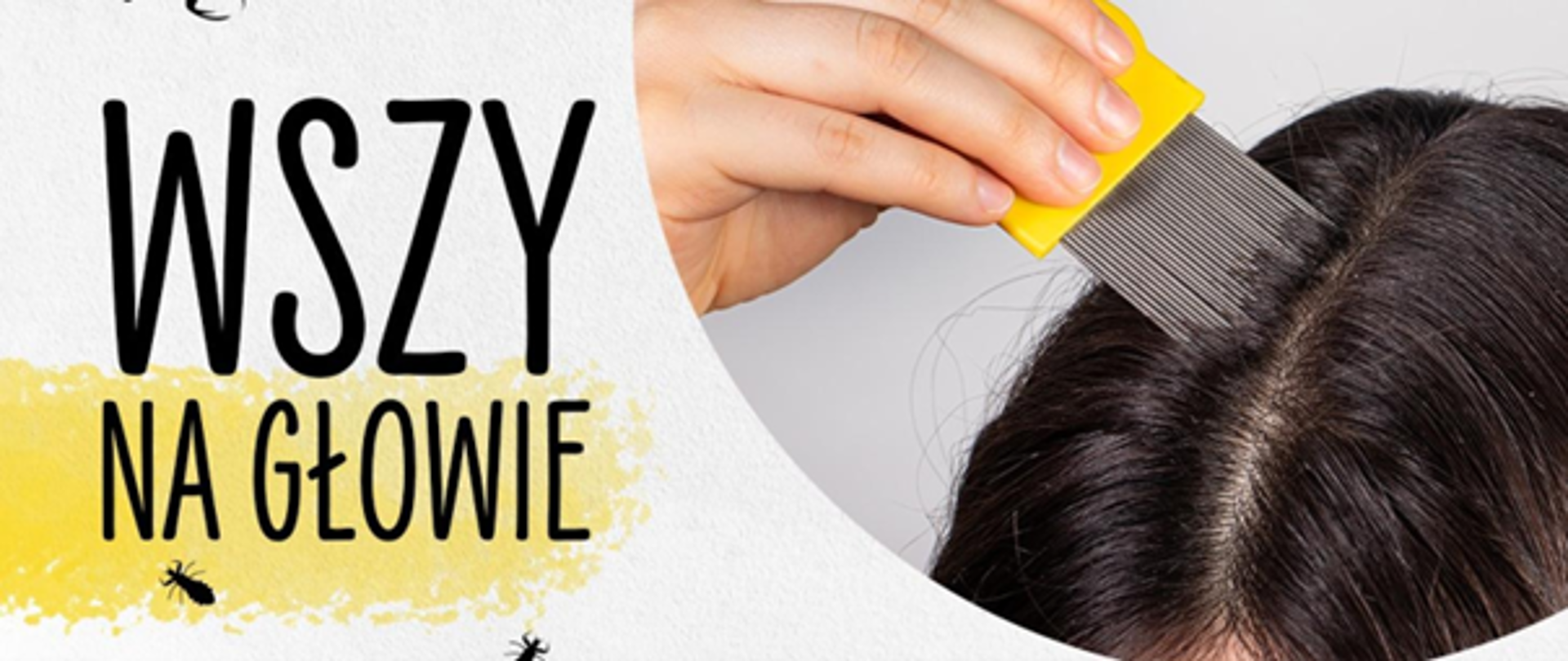 Wszystko o wszawicy.