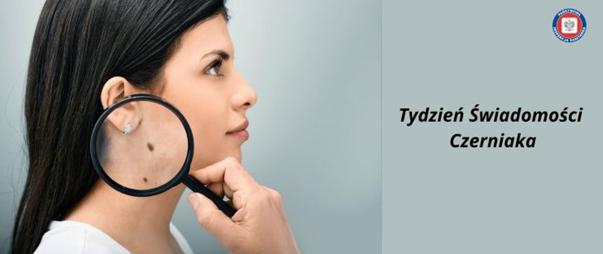 Na szarym tle po lewej stronie zdjęcie profilu kobiety w ciemnych włosach. Kobieta na szyi ma dwa ciemne znamiona, które oglądane są przy pomocy lupy przez lekarza dermatologa Po prawej stronie na środku ciemny napis Tydzień świadomości czerniaka. W prawym górnym rogu okrągłe logo Państwowej Inspekcji Sanitarnej przedstawiające czarnego orła na białym kwadratowym tle, które otoczone jest czerwonym wypełnieniem. Zewnętrzną część logo otacza granatowy okrąg z napisem Państwowa Inspekcja Sanitarna w kolorze białym.