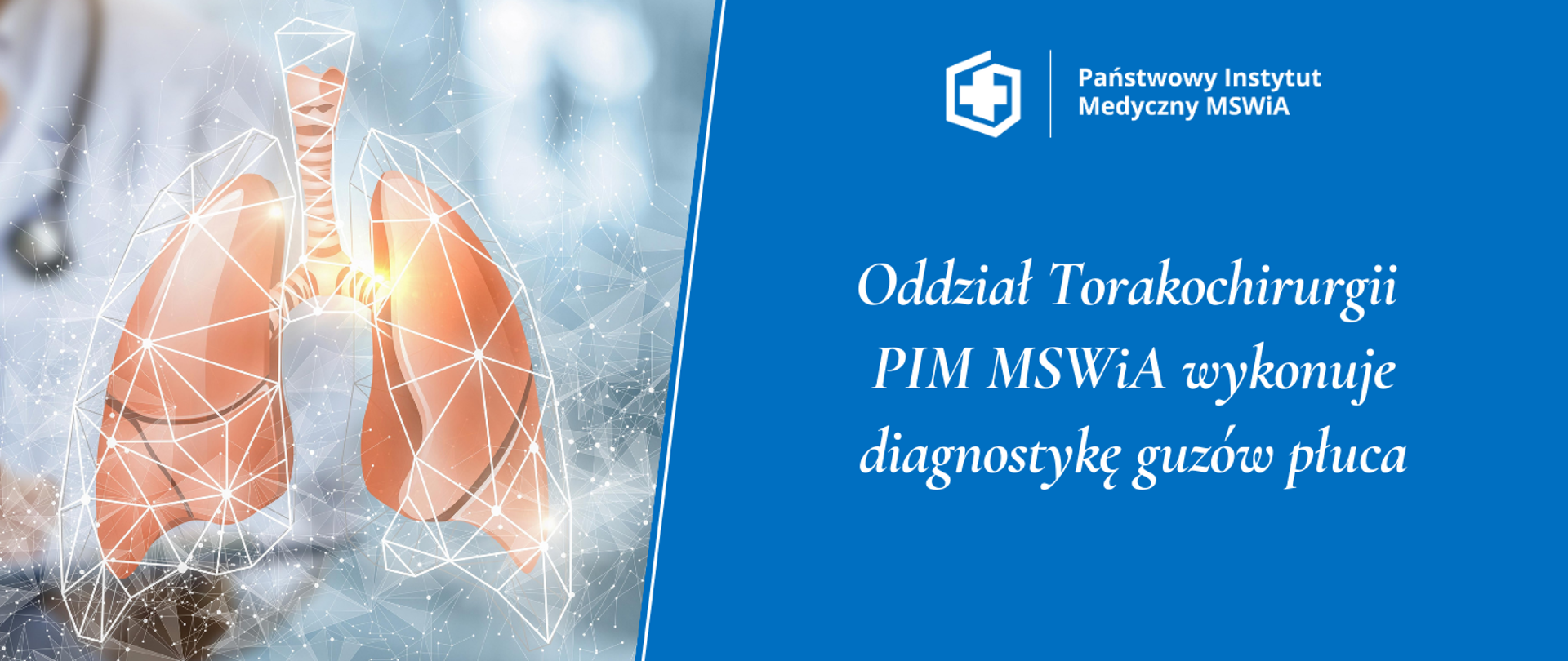 Oddział Torakochirurgii PIM MSWiA wykonuje diagnostykę guzów płuca