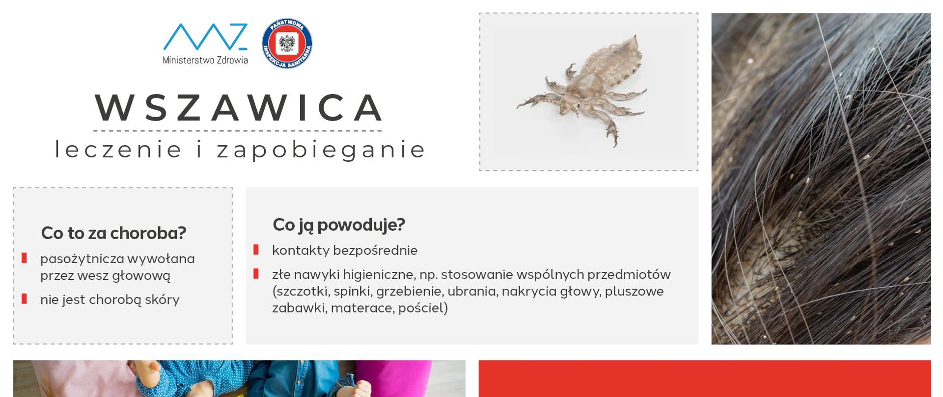 Wszawica