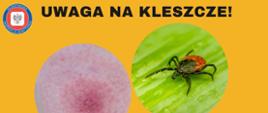 Grafika przedstawia kleszcza i rumień wędrujący oraz rodzaje kleszczy występujących w Polsce.