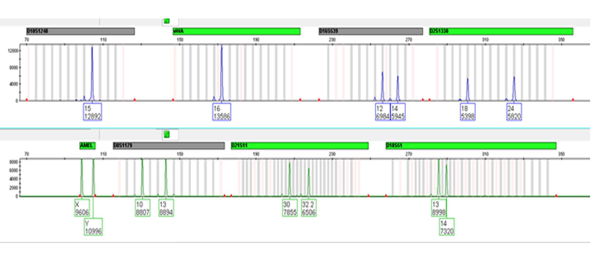 Badania genetyczne kluczowe dla rozwiązania sprawy zabójstwa-baner