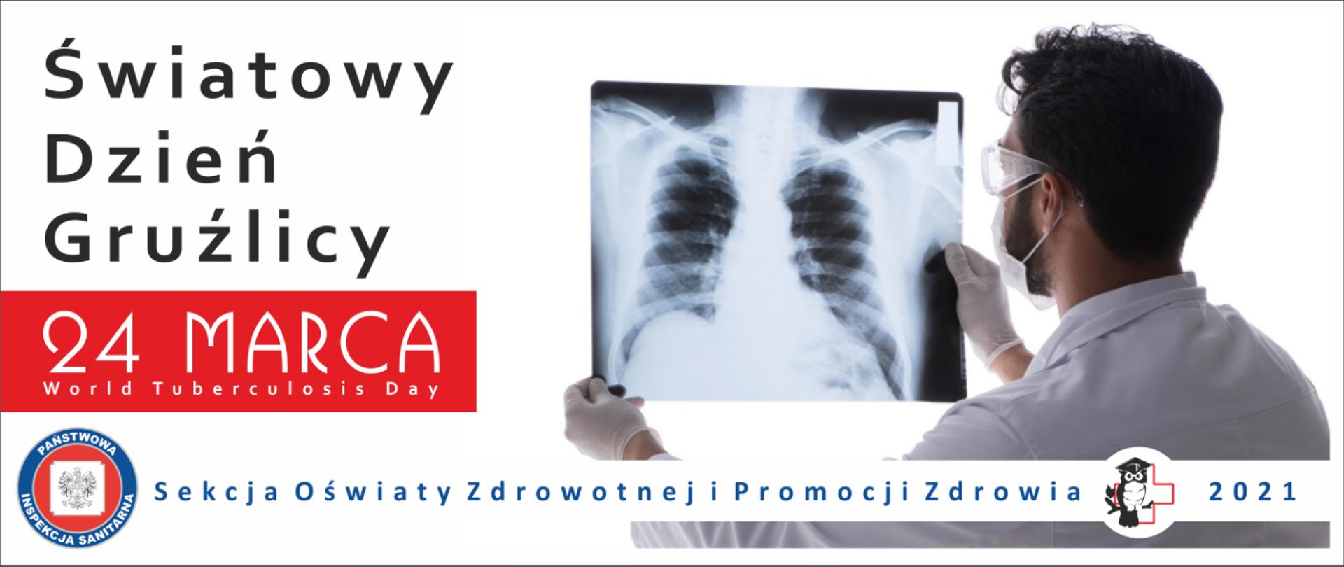 Światowy Dzień Gruźlicy 24 marca 2021