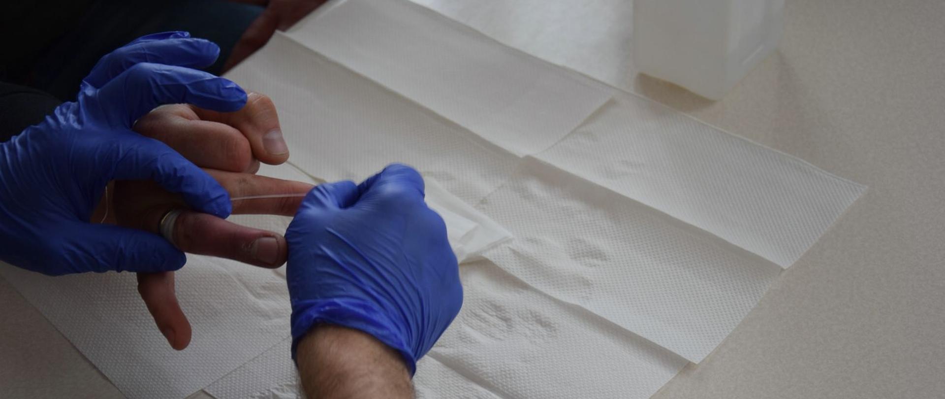 Na zdjęciu ściąganie obrączki ze spuchniętego palca przy użyciu nici