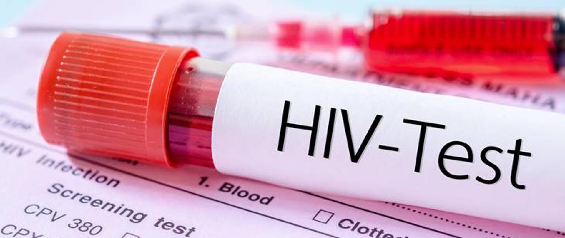 Sample blood collection tube with HIV test label on HIV infection screening test form.