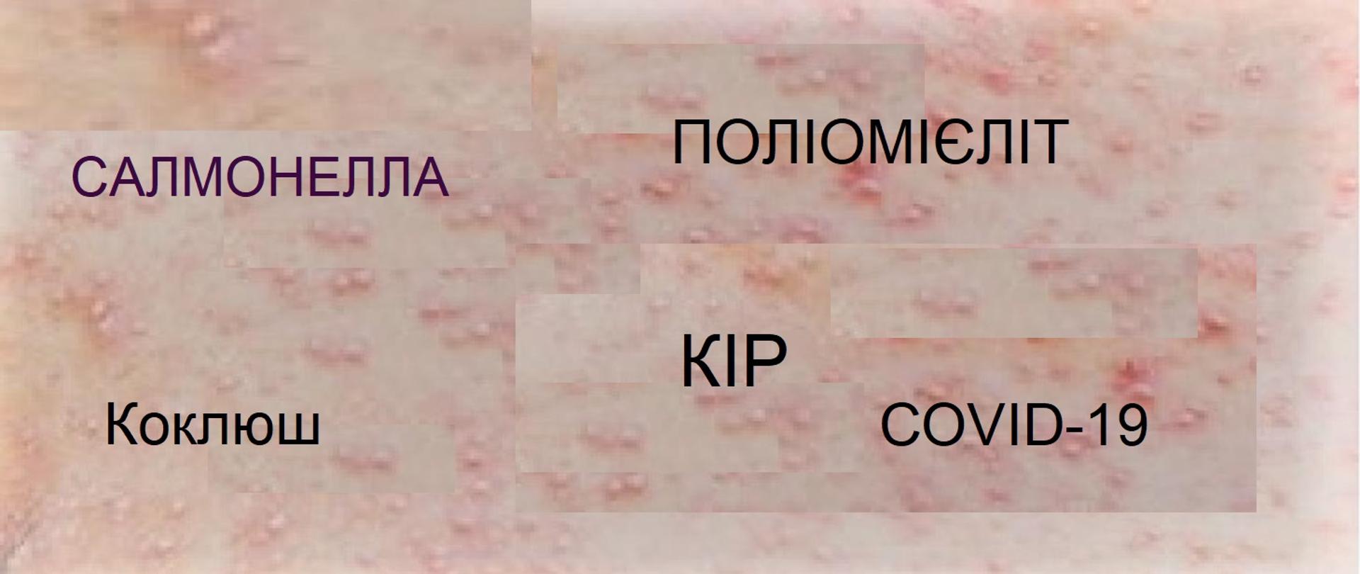 wzw_salmonella_odra_krztusiec_covif-19