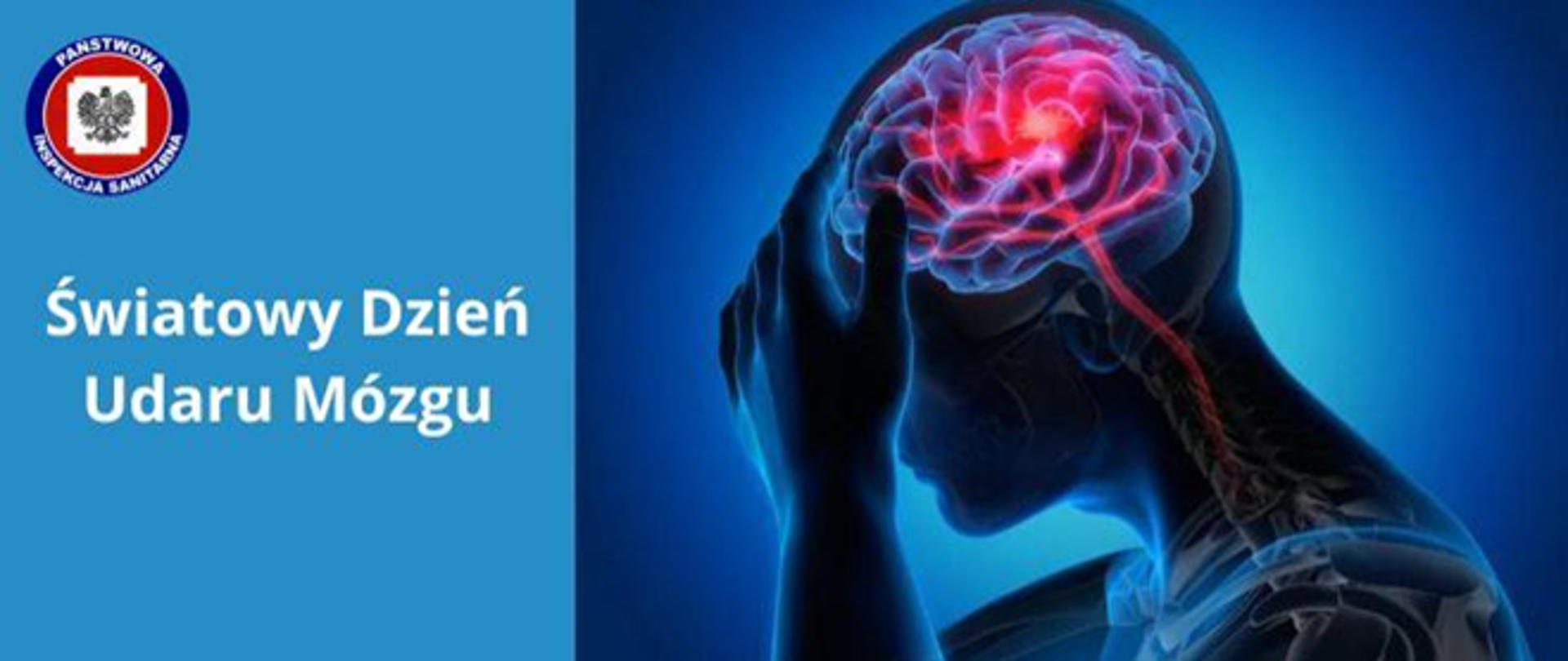 Światowy Dzień Udaru Mózg