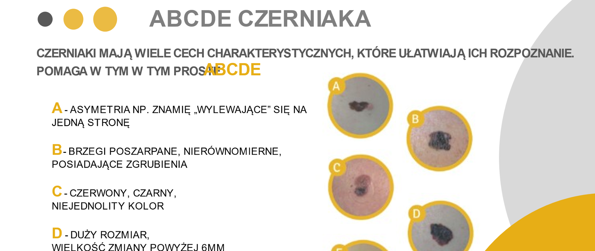 ABCDE_czerniaka