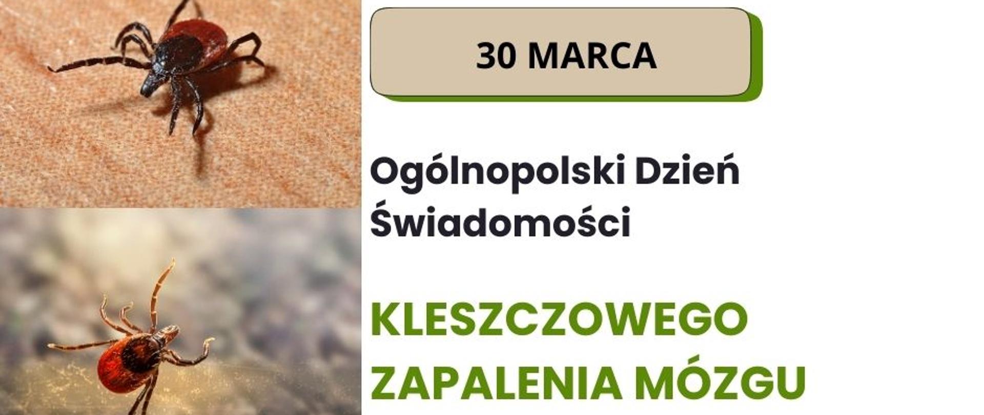 Kleszczowe zapalenie mózgu