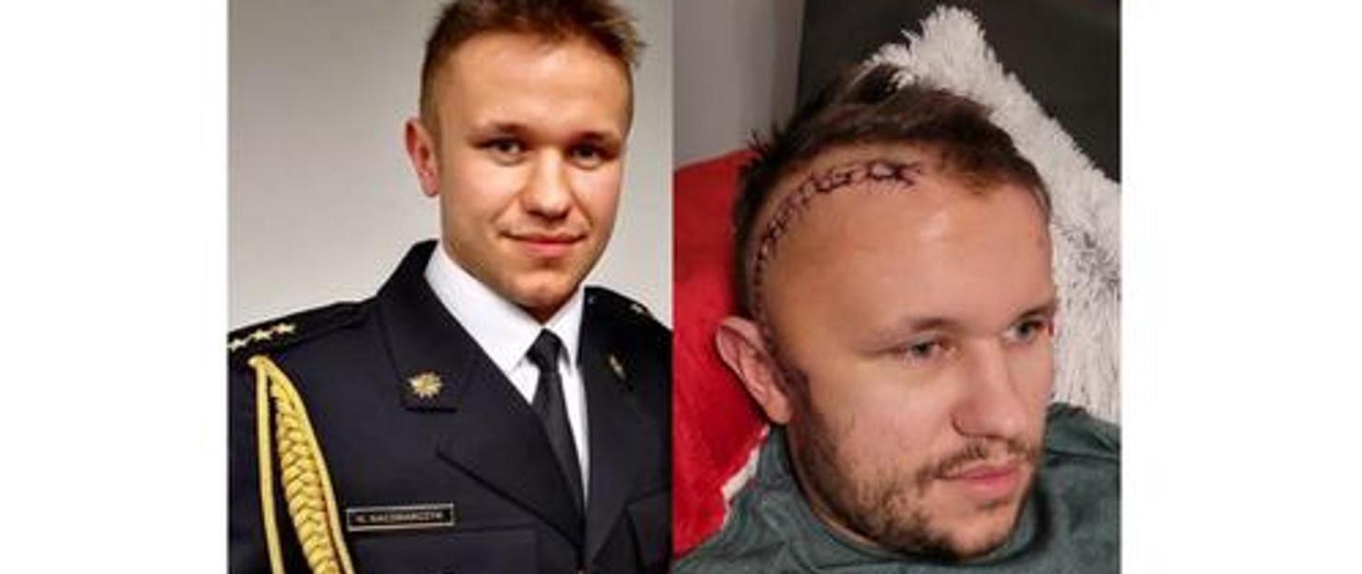 Zastępca dowódcy zmiany w Jednostce Ratowniczo-Gaśniczej PSP w Legionowie - kpt. Kamil Kaczmarczyk walczy z ciężką chorobą nowotworową - glejakiem mózgu, rozlanym gwiaździakiem o średnicy prawie 6 cm.
Miesiąc od informacji o diagnozie przeszedł skomplikowaną i wielogodzinną operację. Niestety guz pozostał… Ze względu na rozmiar i umiejscowienie nie udało się go usunąć w całości.
Środki ze zbiórki zostaną w całości przeznaczone na nierefundowane terapie, wsparcie farmakologiczne i lekarskie, niezbędną suplementację oraz reoperacje. Łączny koszt leczenia w perspektywie rocznej został wyceniony na ok. 600 tys. zł
Prosimy wszystkich ludzi dobrej woli o pomoc, poniżej zamieszczamy link do zbiórki.
https://fundacjarakiety.pl/podopieczni/kamil-kaczmarczyk/
Wesprzeć Kamila możemy poprzez wpłatę na zbiórkę lub przekazanie mu 1,5% swojego podatku.