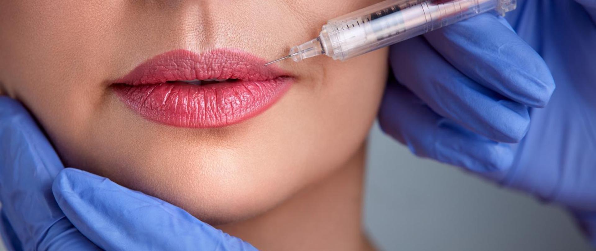 Zdjęcie przedstawia usta kobiety pomalowane na czerwono, w które strzykawka wstrzykiwany jest preparat.