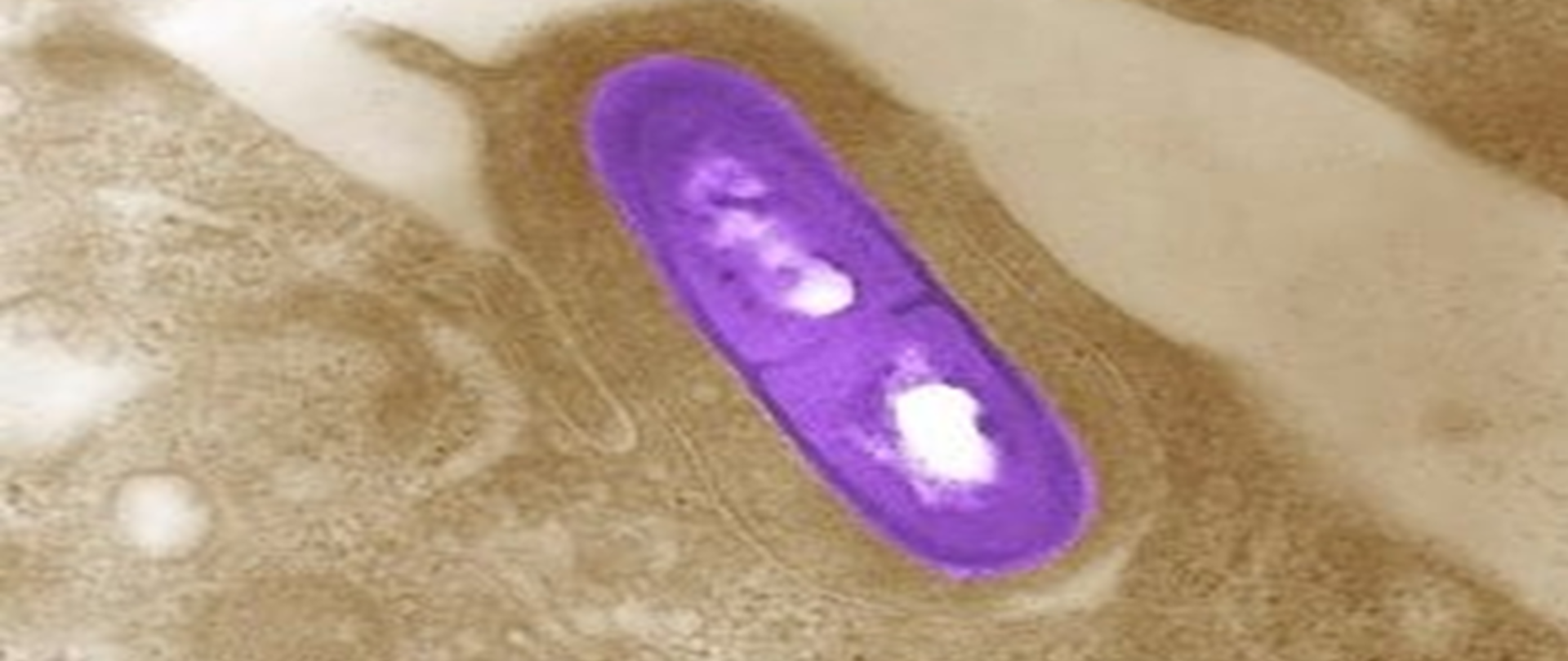 Zdjęcie przedstawia bakterie Listeria monocytogenes, fioletowa na brązowym tle