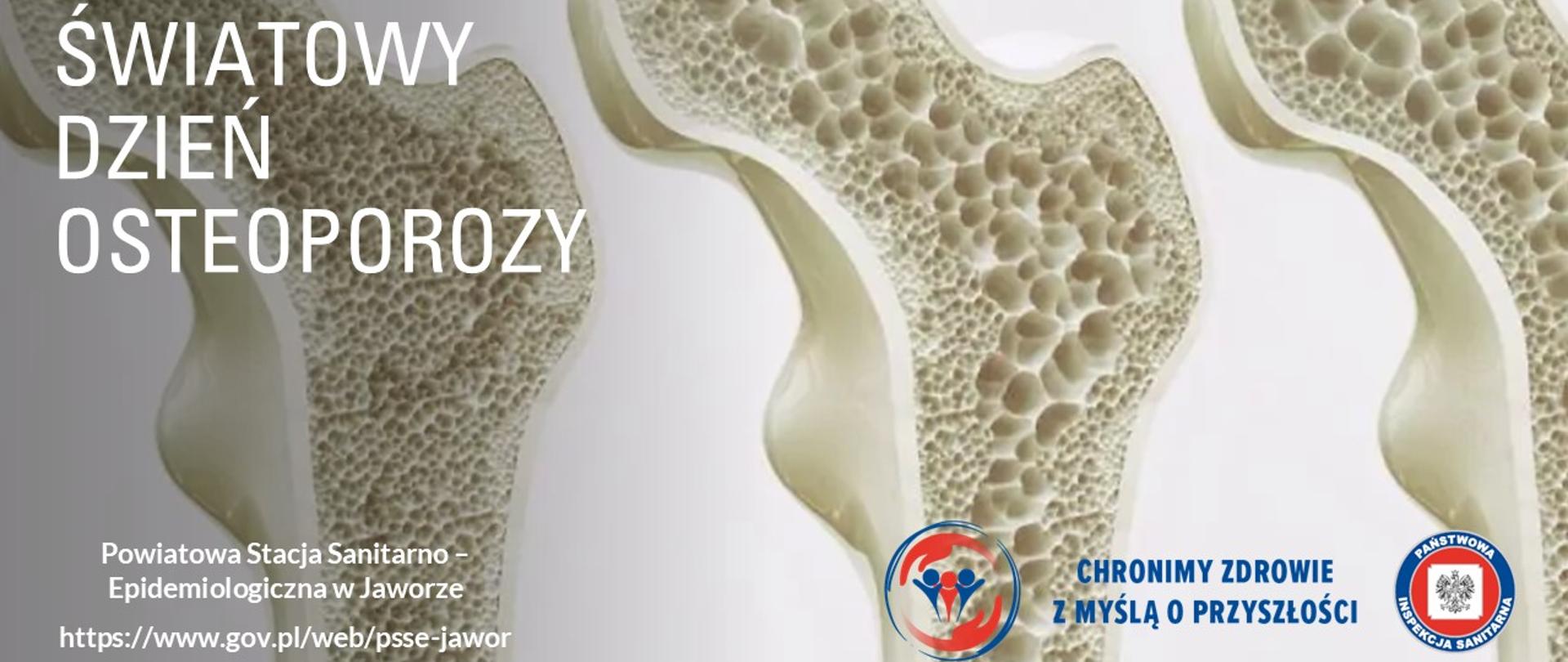 20 października Światowy Dzień Osteoporozy