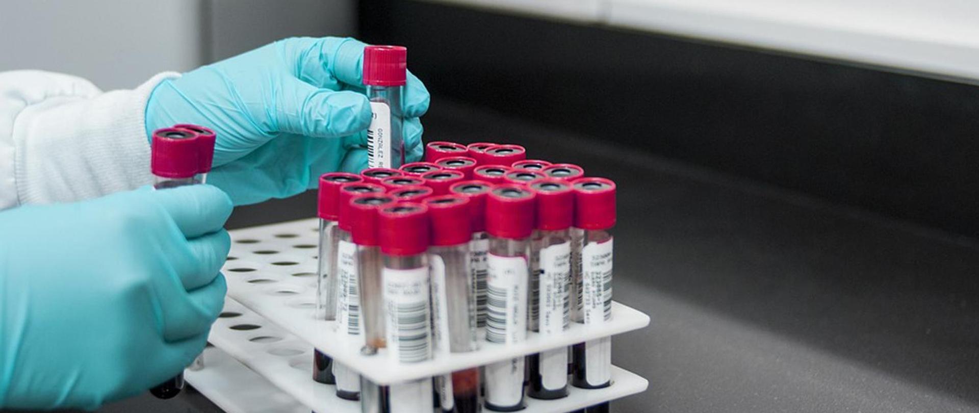 Zasady przeprowadzania pomiarów stężenia alkoholu 