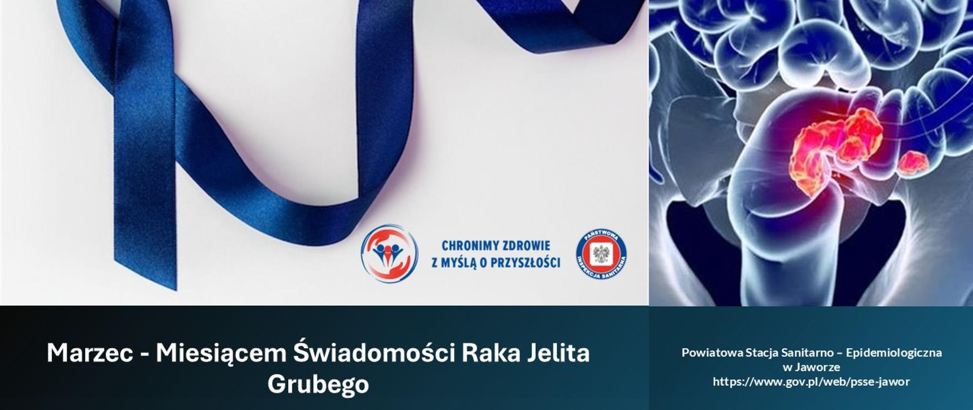 Marzec - Miesiącem Świadomości Raka Jelita Grubego