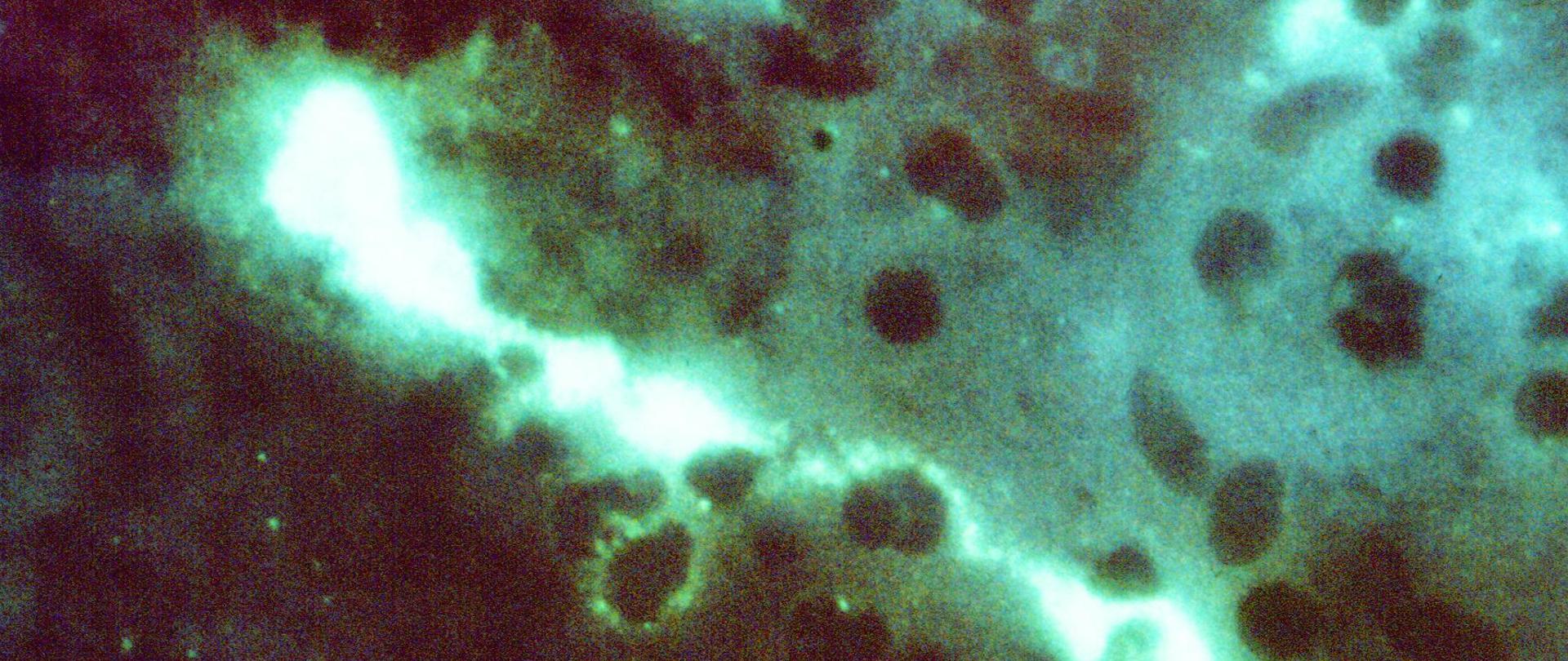 STDs  066 (not an STD although chlamydia is in the name)
Chlamydia Psittaci - Photomic
Direct FA stained mouse brain impressions showing positive staining for Chlamydia psittaci: 400X.
10/71
Lab/Virol., Dr. Vester Lewis
Additional:
Box 1.7, P72-222
Psittacosis is a bacterial infection of humans that can cause severe pneumonia and other serious health problems. From 1988 through 2000, 879 human cases of psittacosis were reported to CDC, and most resulted from exposure to infected pet birds.
Animal Diseases; Bacterial, Rickettsial, Chlamydial, and Mycoplasmal Diseases
