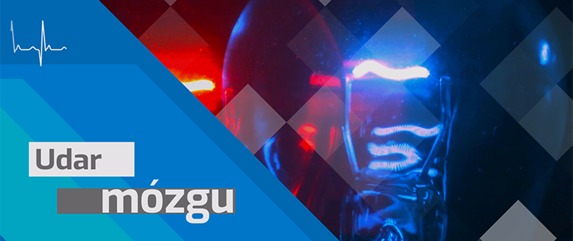 Profilaktyka udaru mózgu - Środa z Profilaktyką 