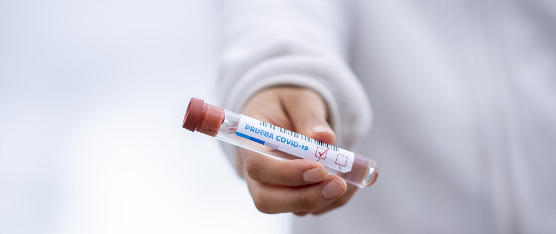 Na pierwszym planie wyciągnięta dłoń trzymająca szklaną próbkę z napisem Covid-19. W dalszym planie kadru widać tułów osoby trzymającej próbkę. Osoba jest ubrana w biały kitel. 