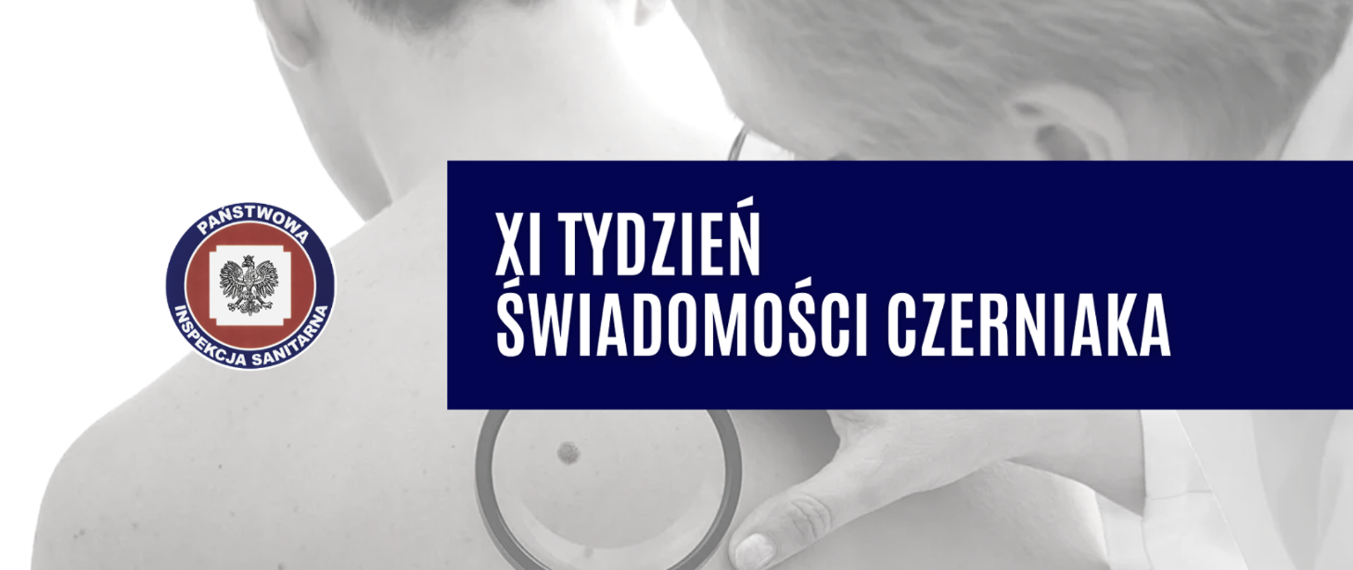 Lekarz badający pod lupą znamię, napis Tydzień Świadomości Czerniaka