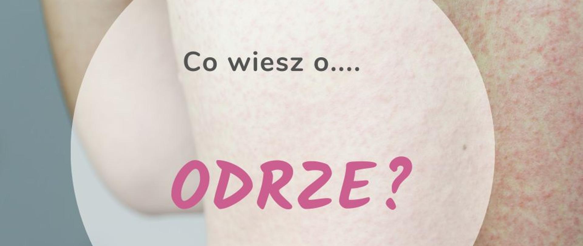 co wiesz o odrze