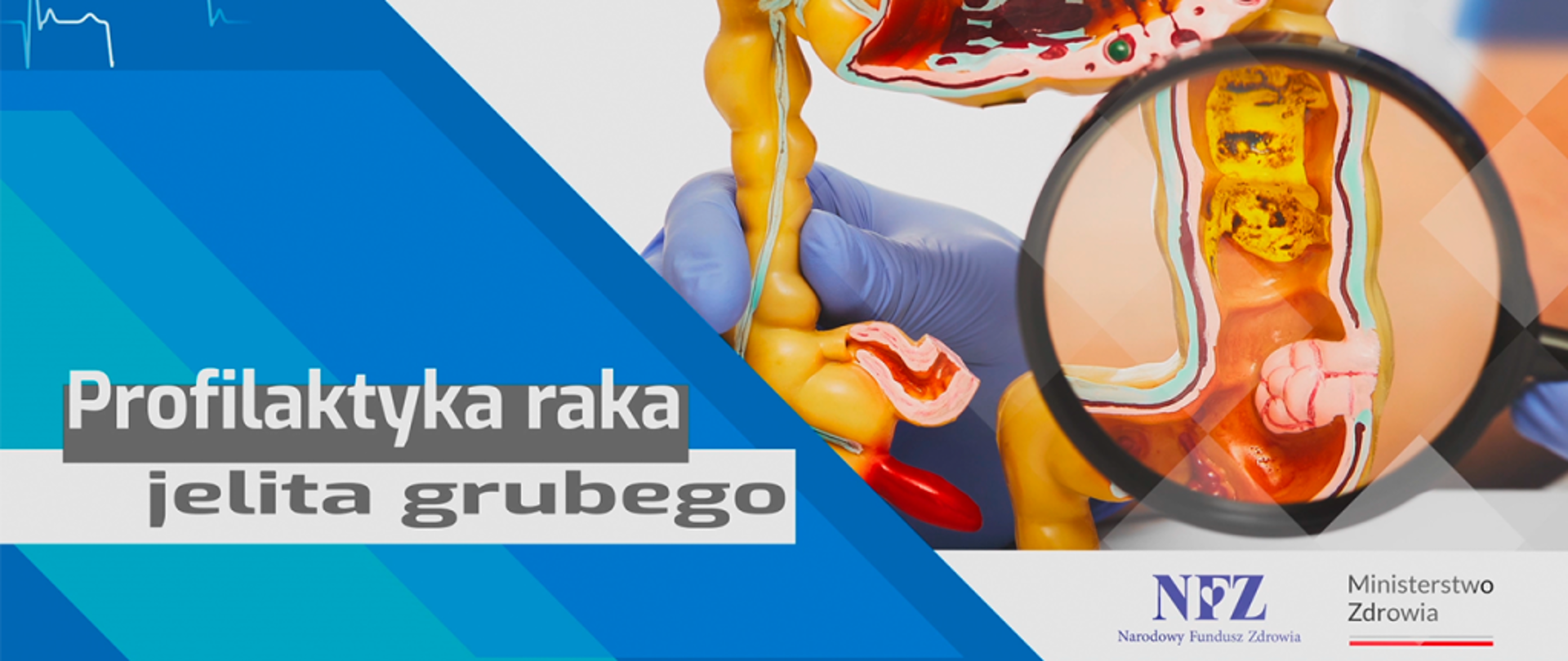 Środa z Profilaktyką - rak jelita grubego