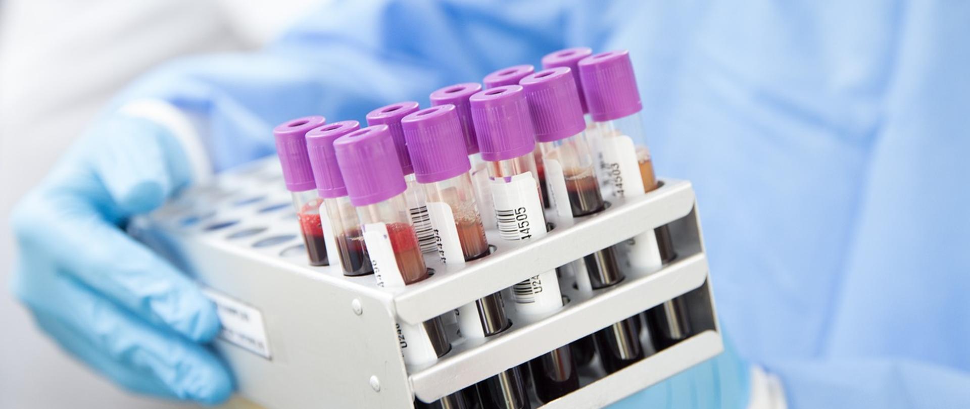 Na zdjęciu osoba w niebieskim ubraniu ochronnym trzymająca w rękach kasetkę z próbkami