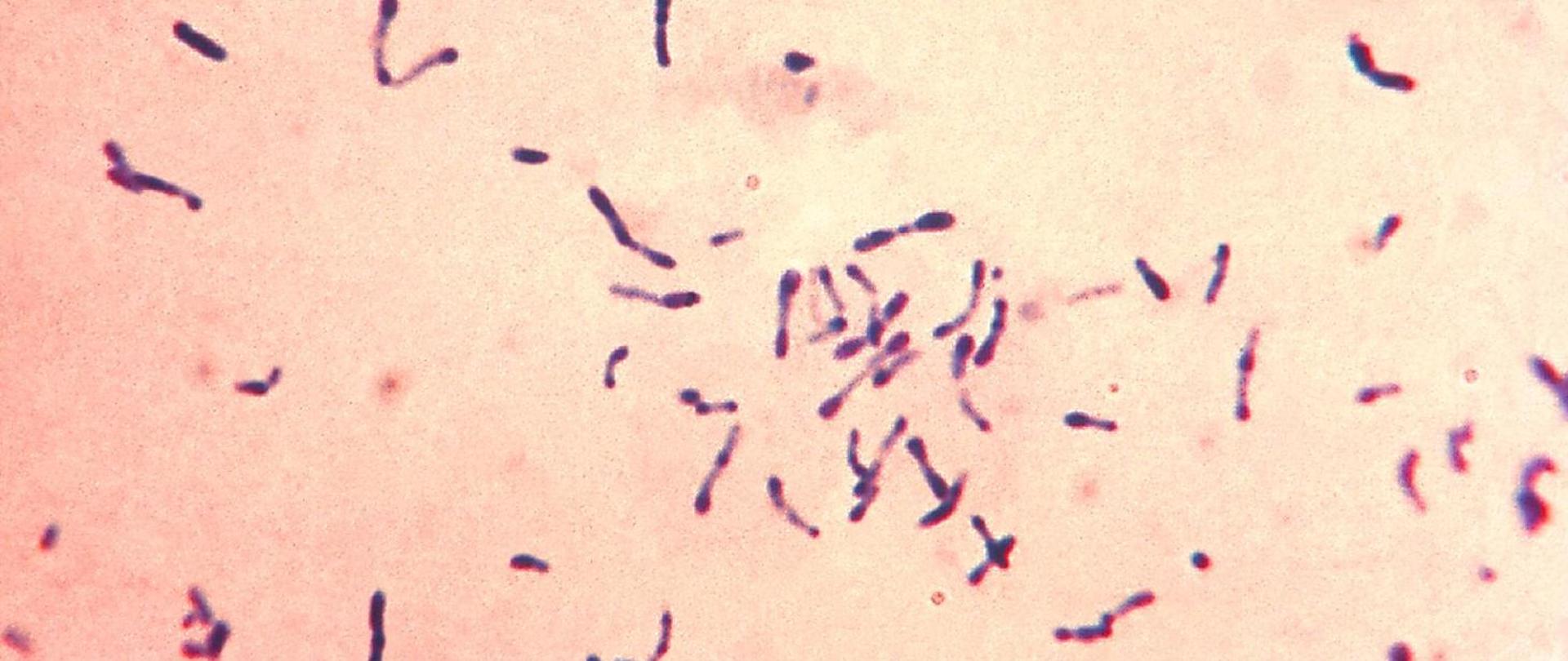 Błonica – choroba, leczenie i zapobieganie