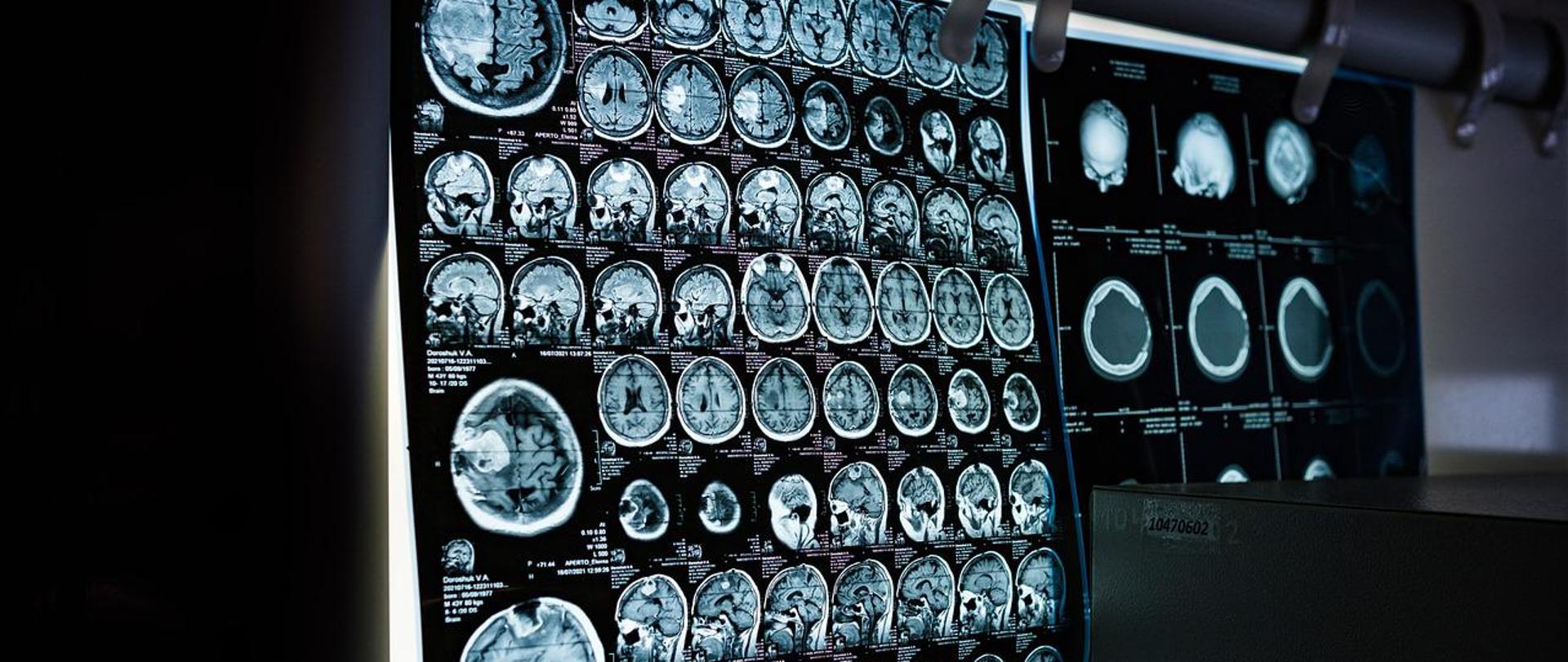 Promieniowanie jonizujące w medycynie