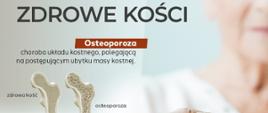 Starsza kobieta opierająca dłonie na lasce