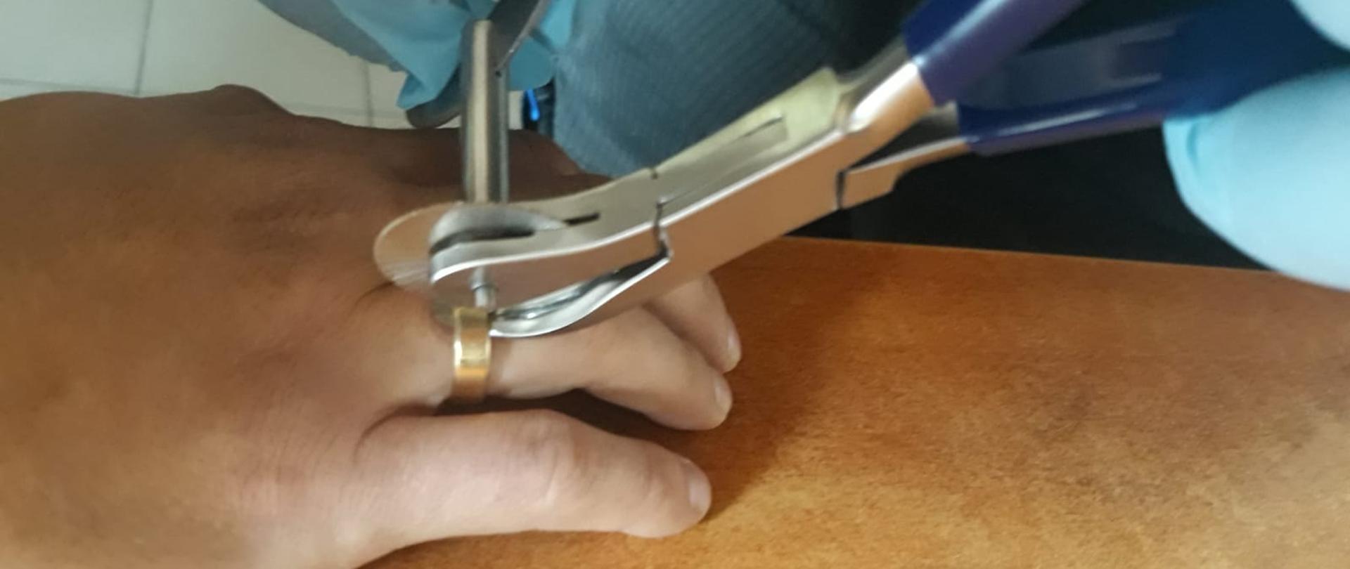 Zdjęcie przedstawia ćwiczenia z usuwania obrączki z palca przy użyciu specjalnego do tego celu narzędzia.