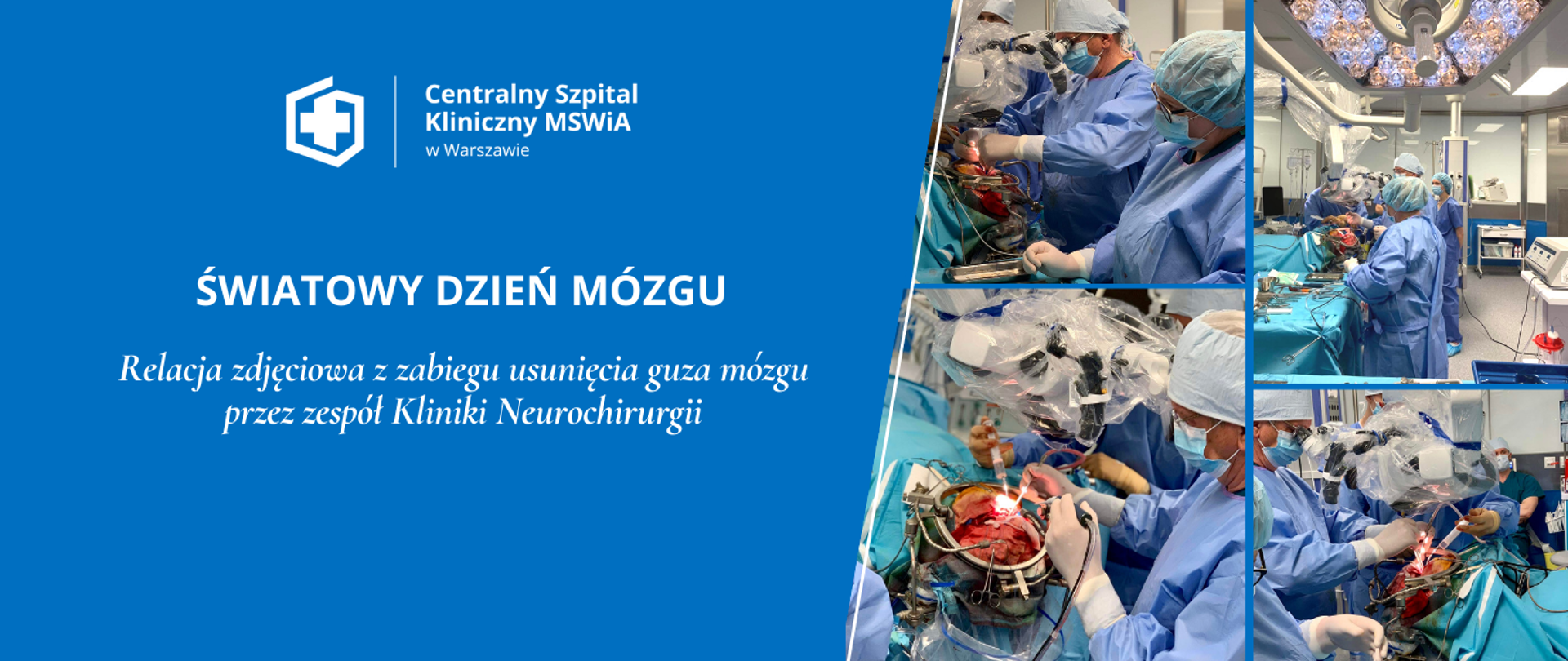 Światowy Dzień Mózgu