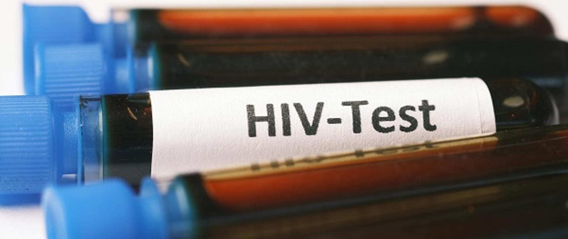 leżące probówki z krwią, na jednej białą naklejka z napisem HIV-Test 